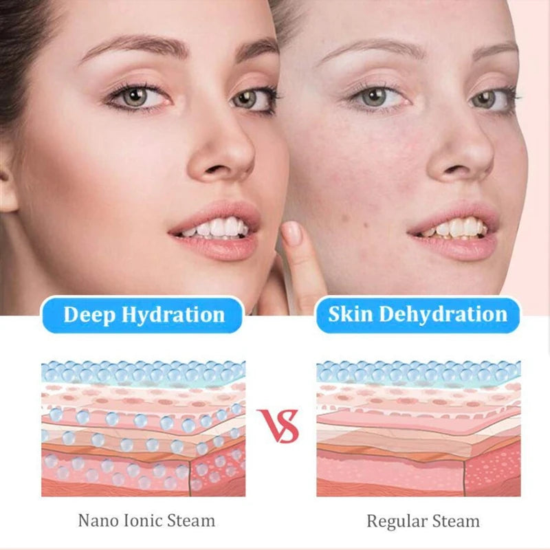 Appareil Microdermabrasion Diamant Sans Fil Beauty Star – Anti-Rides & Points Noirs | LuxVrouw LuxVrouw