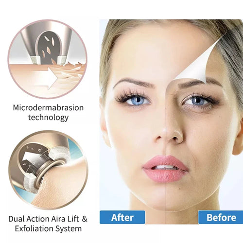 Appareil Microdermabrasion Diamant Sans Fil Beauty Star – Anti-Rides & Points Noirs | LuxVrouw LuxVrouw